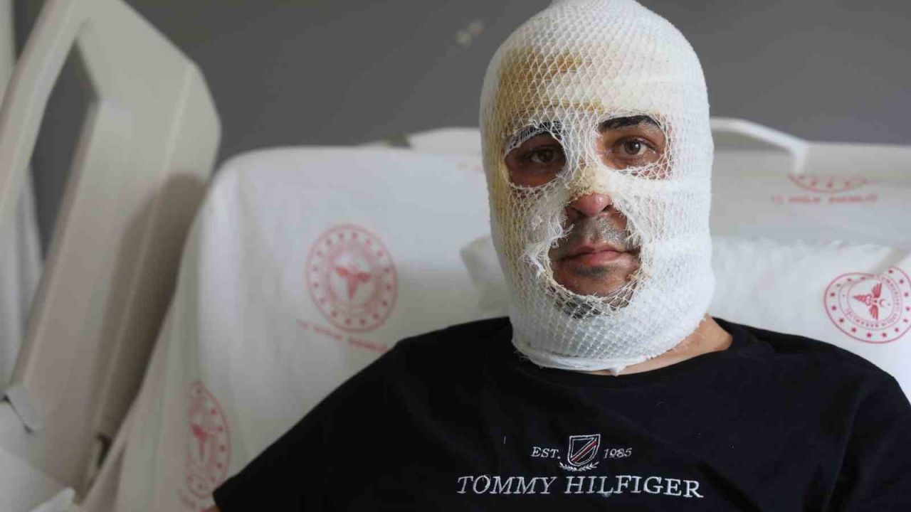 Ekmek teknesi küle dönmesin diye mücadele eden esnafın yüzü ve vücudu yaşanan patlamayla yandı