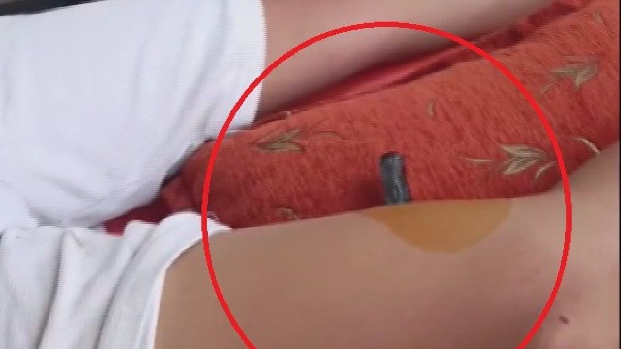 Bahçeye kaçan topu almak isteyen çocuğun bacağına korkuluk demiri saplandı